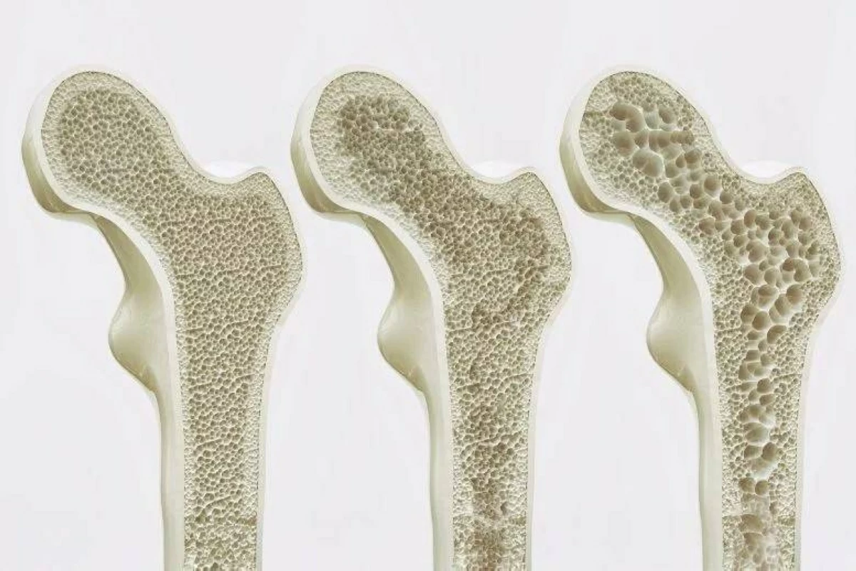  خلايا العظمية مسؤولة عن بناء العظام 