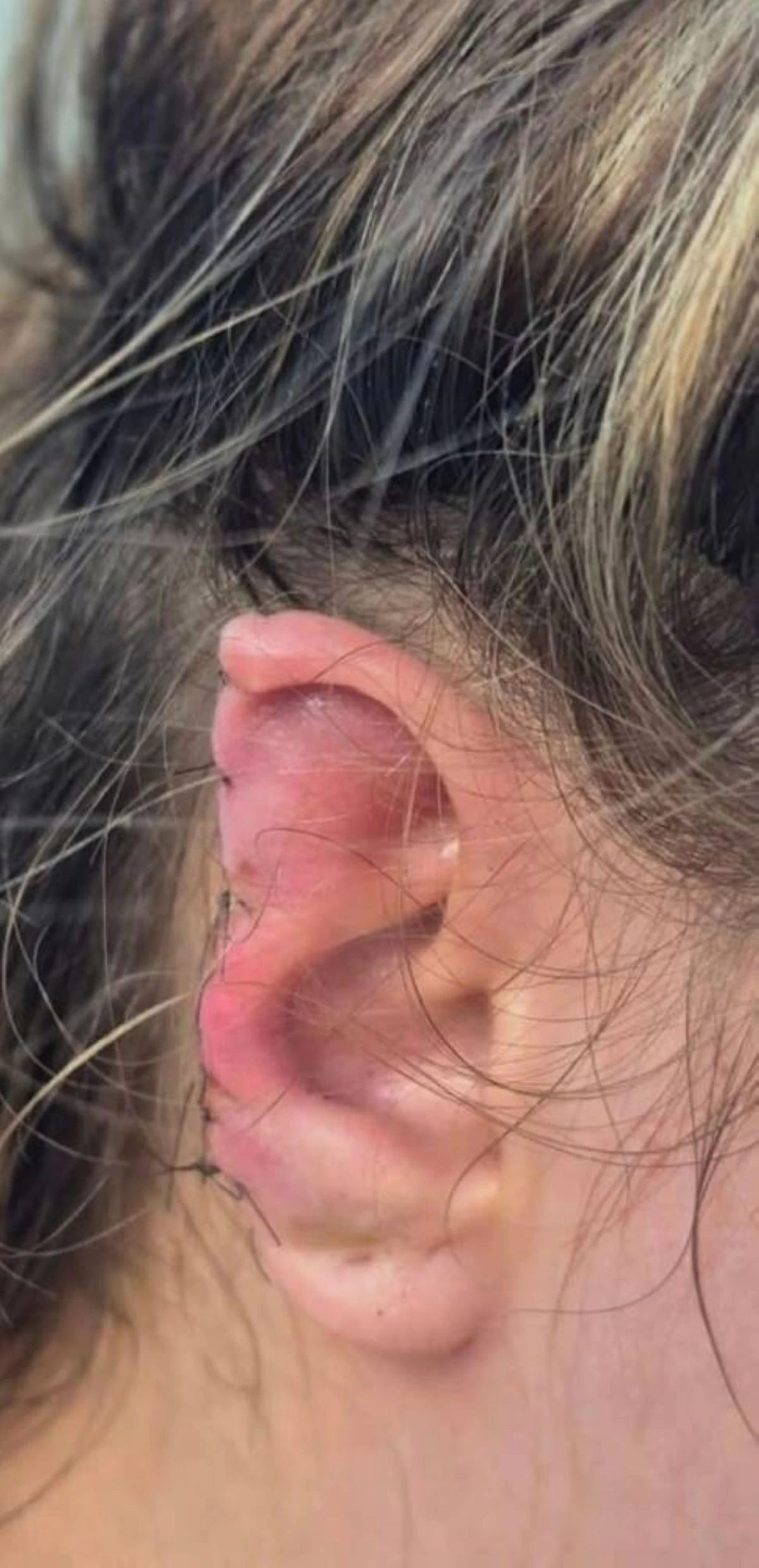 أذن زوجته بعد قضمها