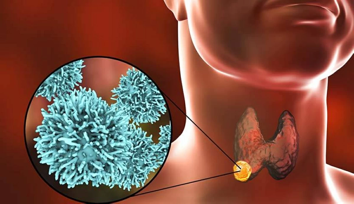 اكتشاف «التنشيط الذاتي» لبروتين مسبب للسرطان #صحيفة_الخليج 