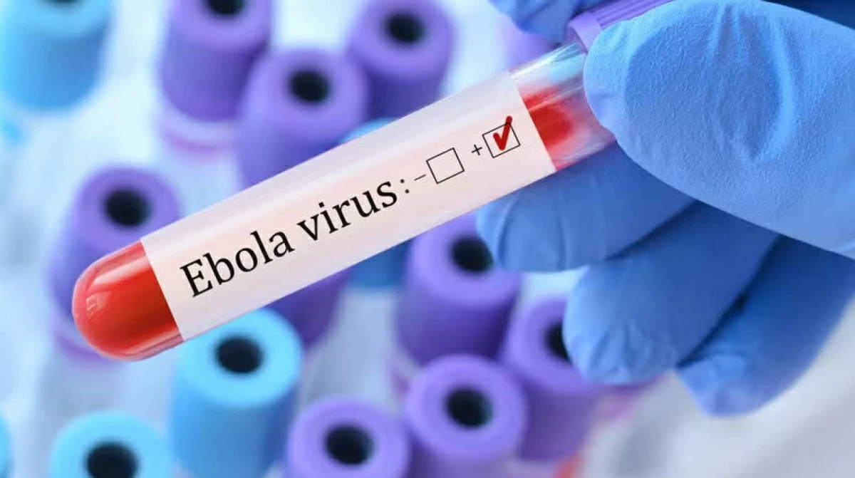 مصر تنصح مواطنيها بتأجيل السفر إلى المناطق المتضررة من «إيبولا»