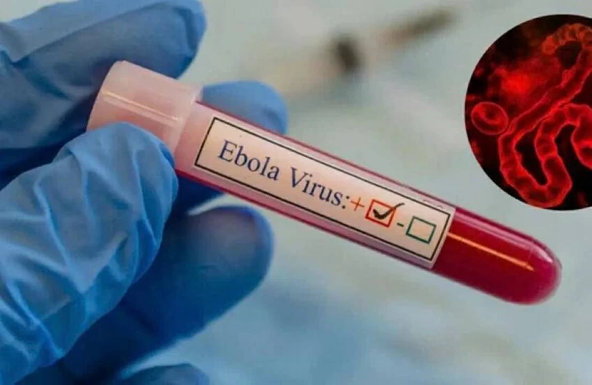 «إيبولا» يتفشى بسرعة كبيرة في الكونغو الديمقراطية وأوغندا