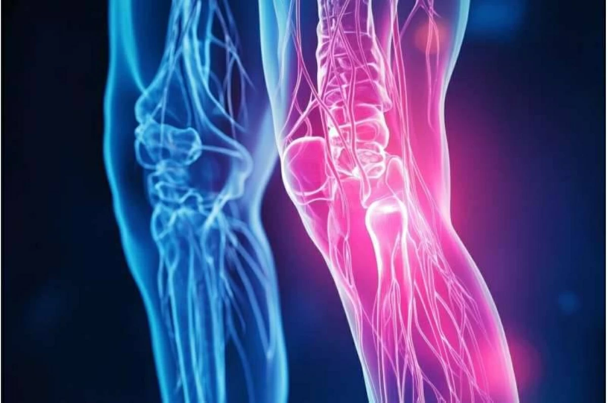 تقنية تعزز علاج المفاصل المصابة