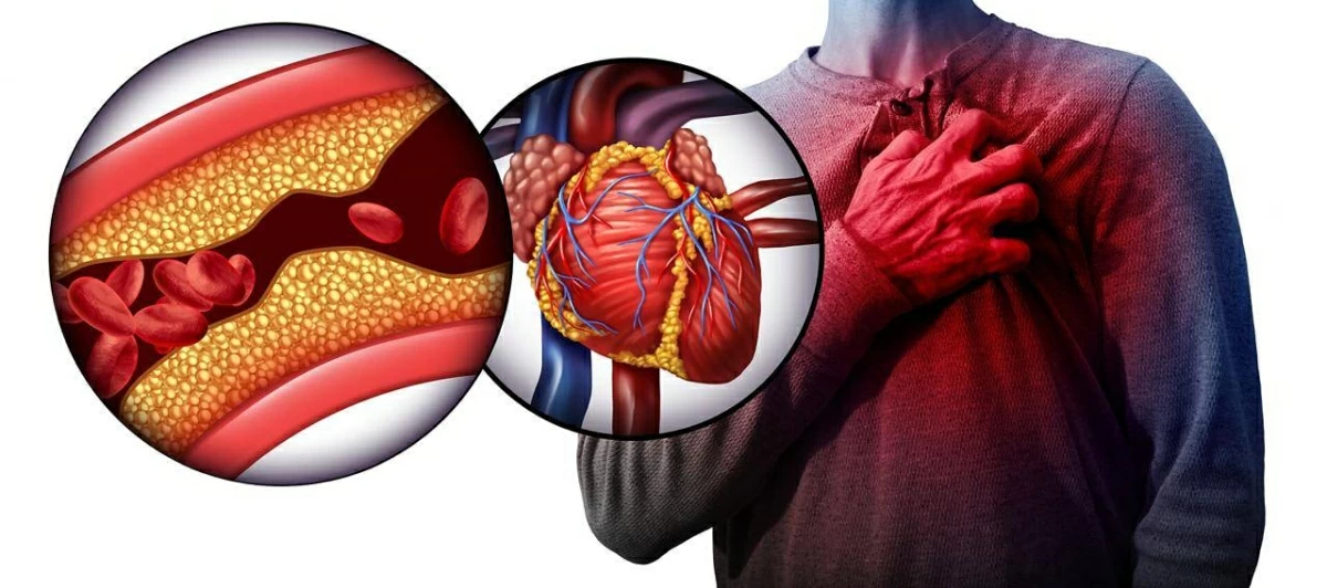 لا تتجاهلها.. 7 علامات خطرة تسبق النوبة القلبية بساعة