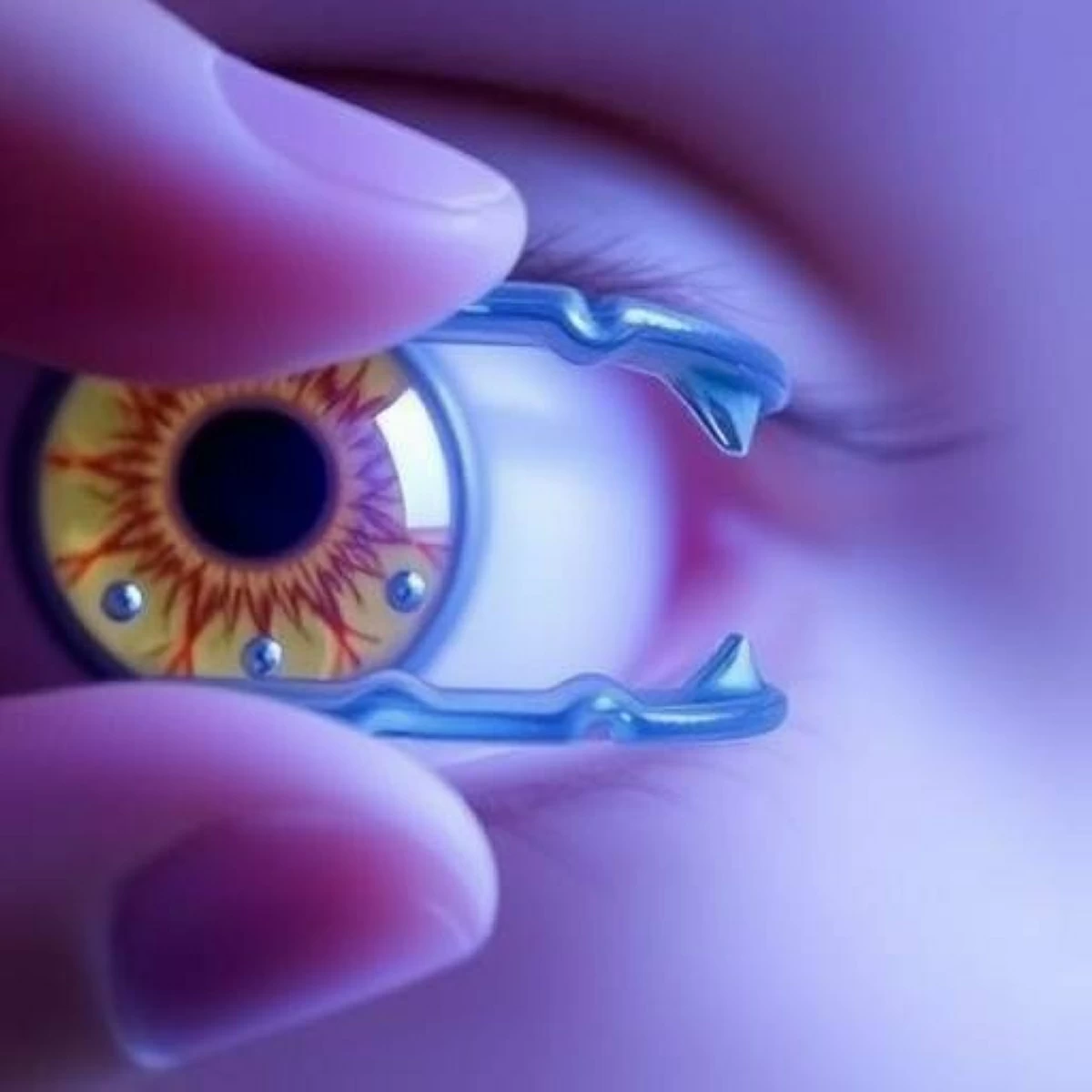 عدسة لاصقة ثلاثية الأبعاد