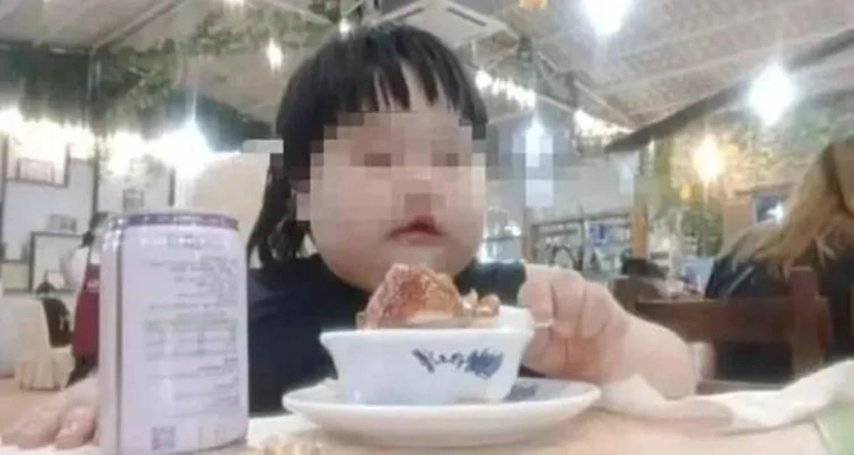 طفلة 3 سنوات تزن 35 كيلوغراماً بسبب «موكبانج»