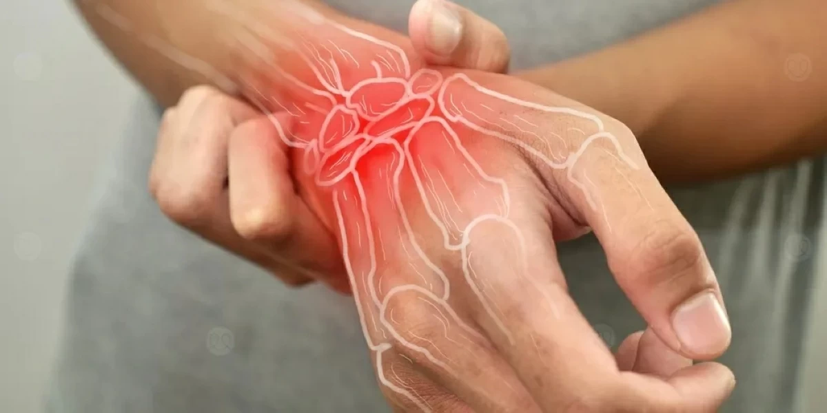 علاج بالذكاء الاصطناعي لالتهاب المفاصل العظمي
