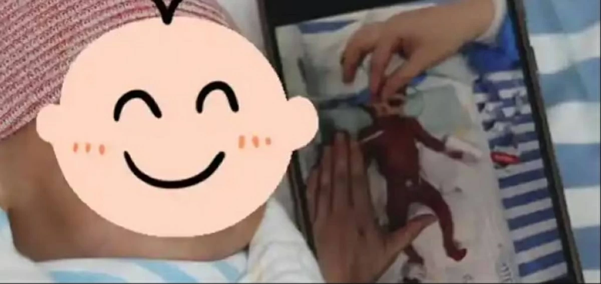 المولود بحجم كف اليد