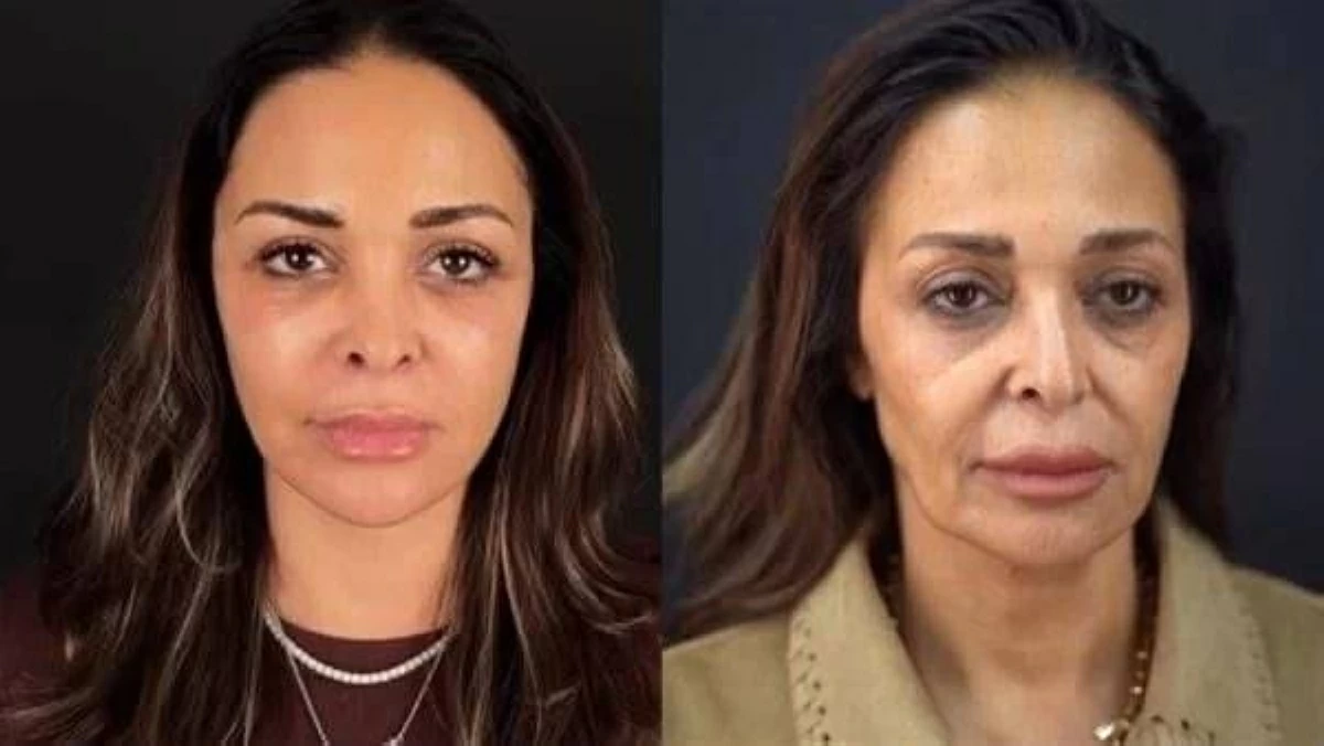 من إليسا إلى غادة عادل.. نجمات اعترفن بتجارب تجميل انتهت بالندم