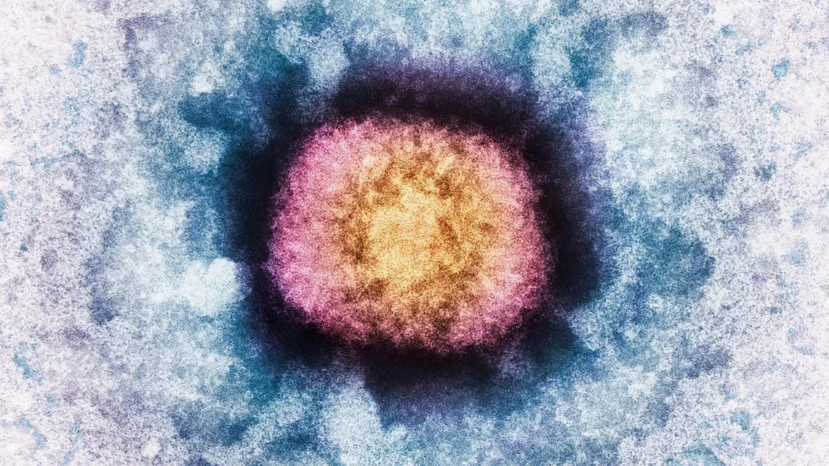 Human BC200 Gene Sequences Discovered in Molluscum Contagiosum Virus