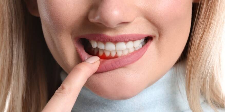 أمراض اللثة والتسوس قد تقود إلى مشاكل جسدية لا تخطر على البال