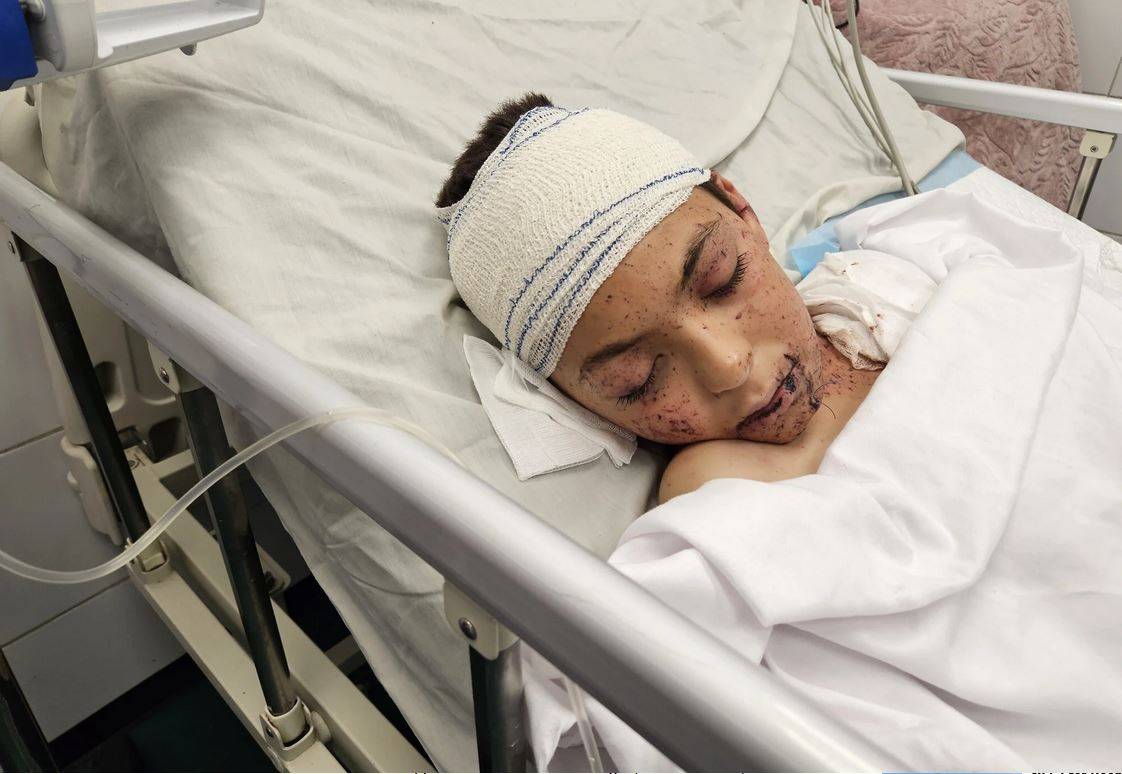 صبي فلسطيني فقد 9 من أشقائه بغارة إسرائيلية يتلقى العلاج في إيطاليا صبي فلسطيني فقد 9 من أشقائه بغارة إسرائيلية يتلقى العلاج في إيطاليا
