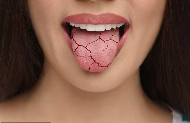 جل للتجاعيد يمهد الطريق لترطيب جفاف الفم المزمن جل للتجاعيد يمهد الطريق لترطيب جفاف الفم المزمن