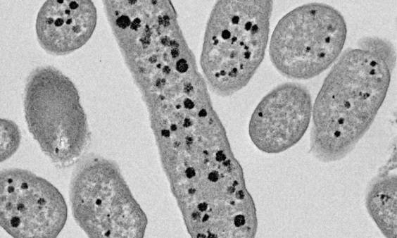 «باكتيرويدس ثيتايوتاميكرون»