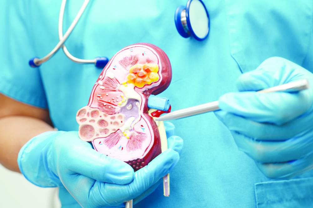 «دبي الصحية»: 46% نمواً في عمليات زراعة الكلى خلال 2025 