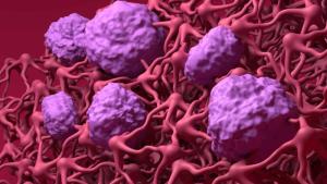 خلايا مصابة باللون الزهري