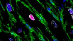 الأجزاء باللون الوردي هي الخلايا المتجددة
