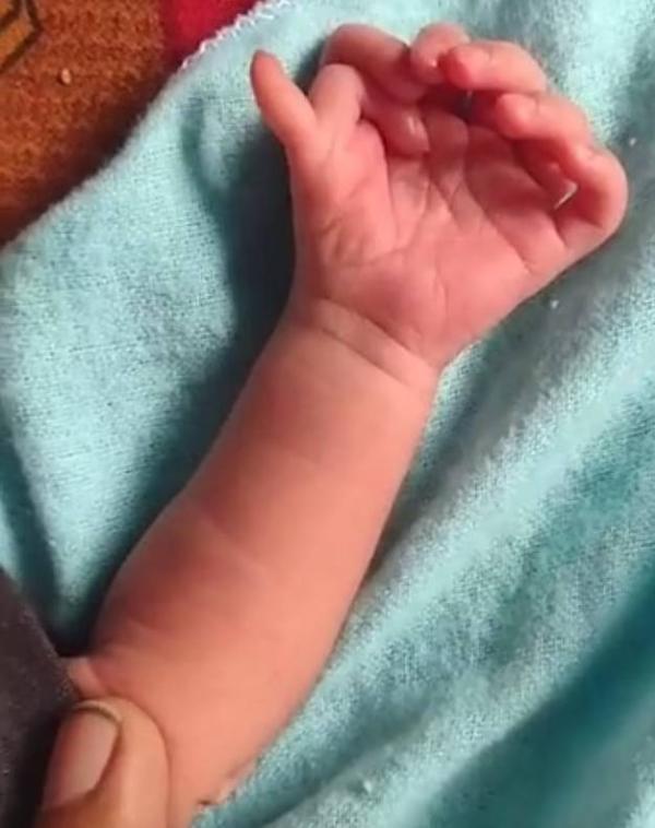 7 أصابع باليد 1