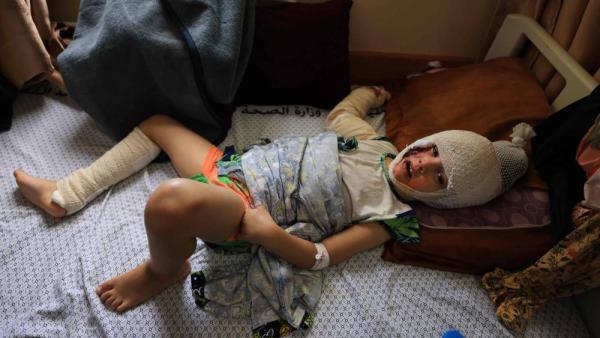 قنابل إسرائيل تحرق جلود أهالي غزة.. والعلاج شحيح جداً