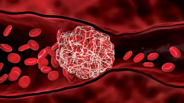 مميعات الدم