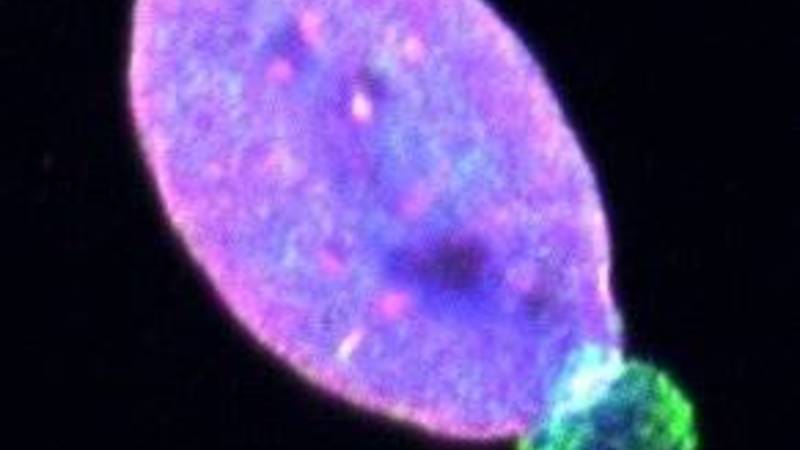 صورة توضيحية لنواة خلية ميلانية