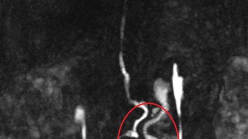 تصوير الأوعية اللمفاوية الديناميكي بالرنين المغناطيسي