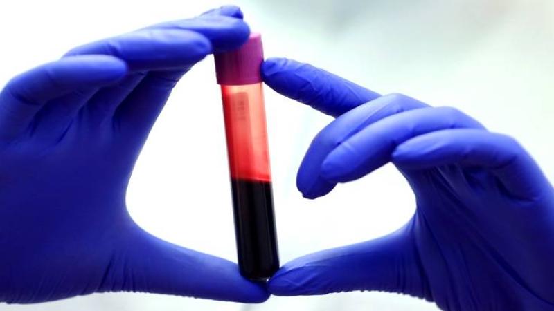 اختبار الدم يكشف العمر البيولوجي للإنسان