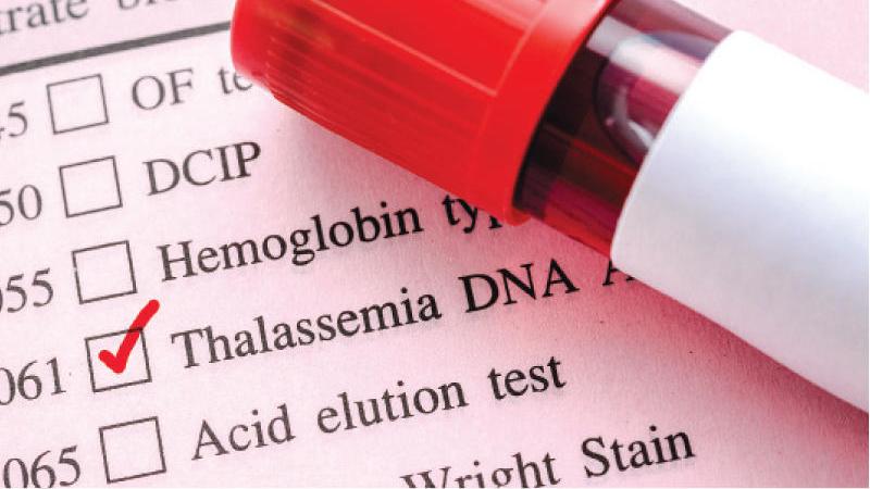 تحذير من الحمل الطبيعي للأزواج مصابي الثلاسيميا | صحيفة الخليج