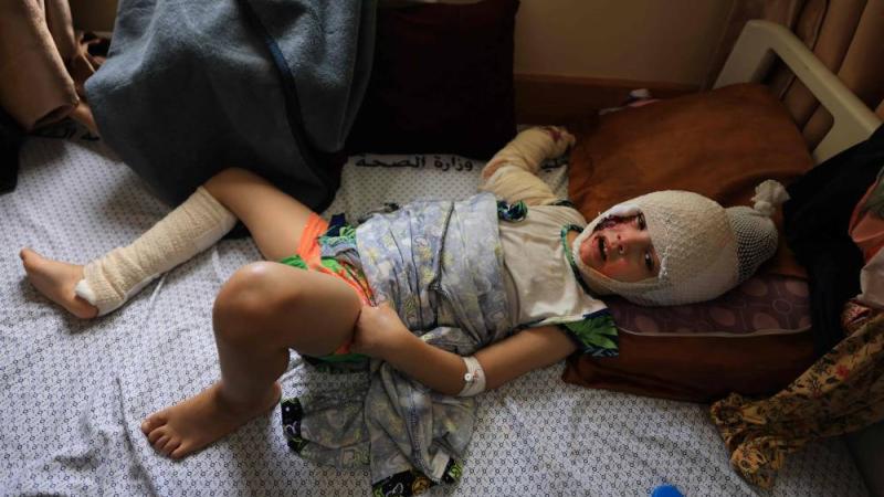 قنابل إسرائيل تحرق جلود أهالي غزة.. والعلاج شحيح جداً