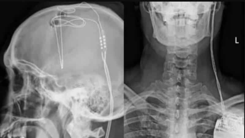 أثناء التجربة