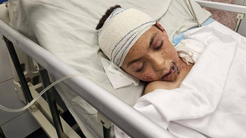 صبي فلسطيني فقد 9 من أشقائه بغارة إسرائيلية يتلقى العلاج في إيطاليا