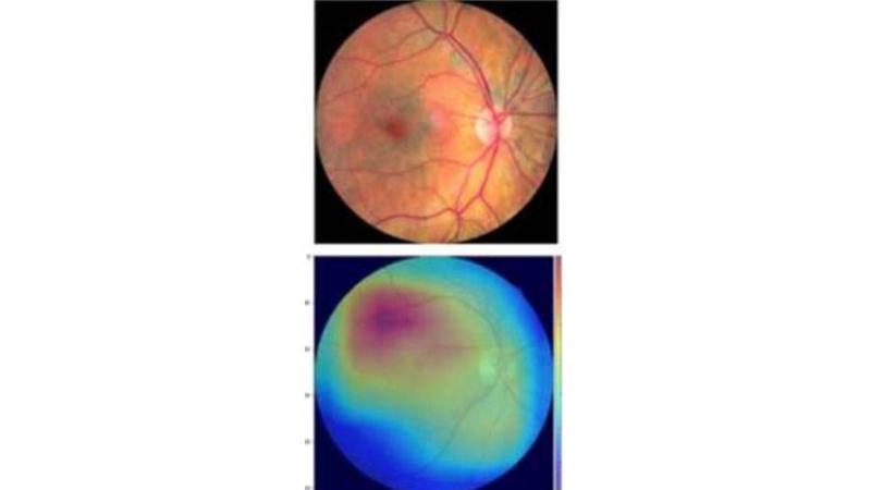 صورة أثناء إجراء الدراسة