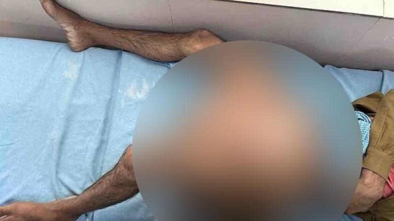 ورم يزن 35 كيلو من ساق هندي