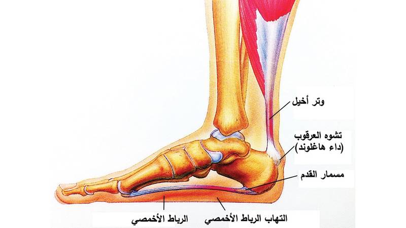 هل الاملاح تسبب مسمار القدم؟