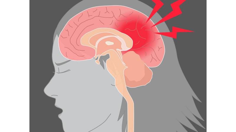 أورام الغدةالنخامية الكشف المبكر يقي من المضاعفات صحيفة الخليج