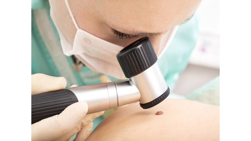 سرطان الجلد علامات صامتة ومخاطر شديدة صحيفة الخليج