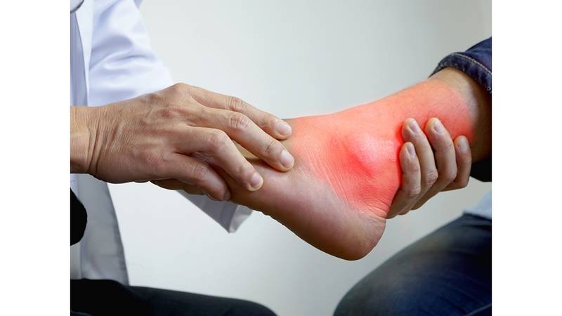 هل تعاني من الحصوات من نبات ابن العطار العشبي؟ فيسبوك