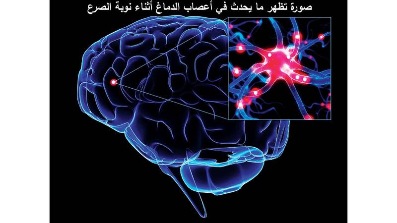 الصرع وكهرباء الدماغ ملحق الصحة و