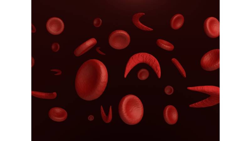 الوراثة وراء فقر الدم المنجلي صحيفة الخليج