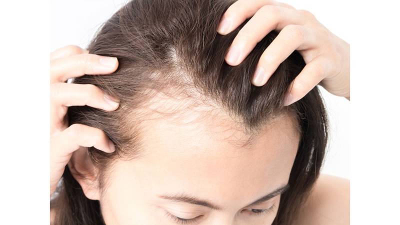 سبعة أسباب تؤدي إلى ضعف الشعر وتساقطه في جريدة الخليج