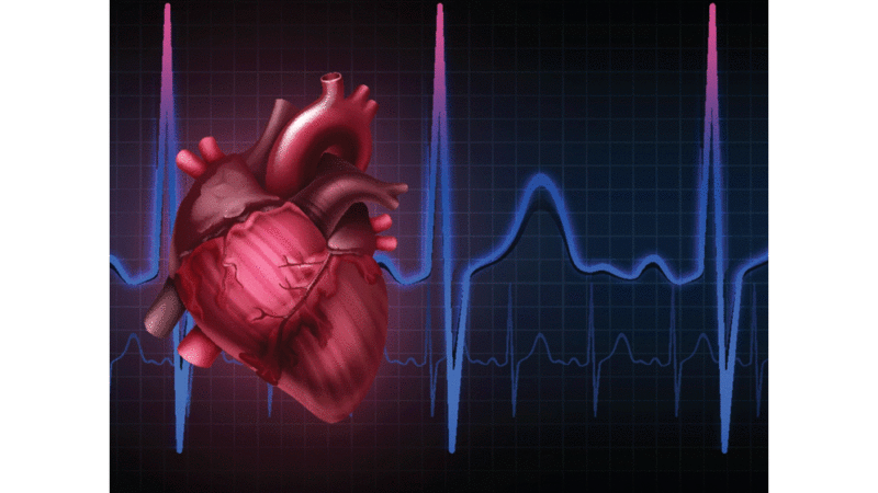 اضطراب نظم القلب التشخيص والعلاج Mayo Clinic مايو كلينك