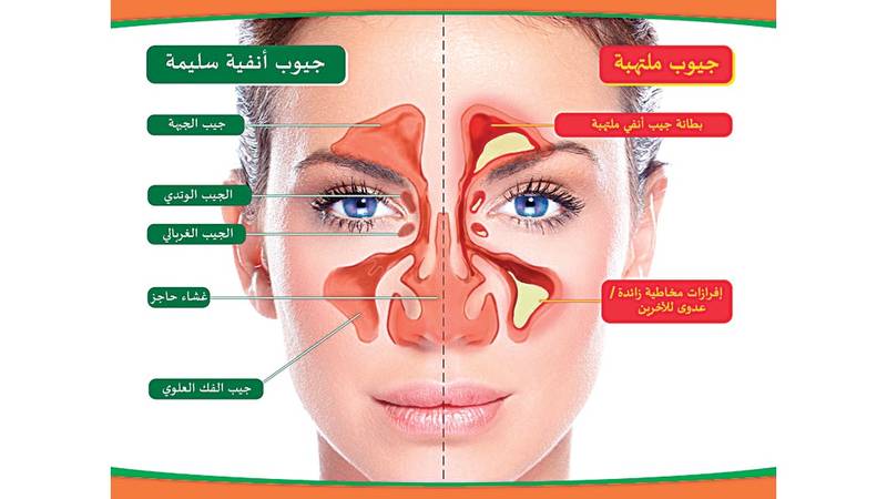 الجيوب الأنفية بوابة المتاعب للجهاز التنفسي صحيفة الخليج