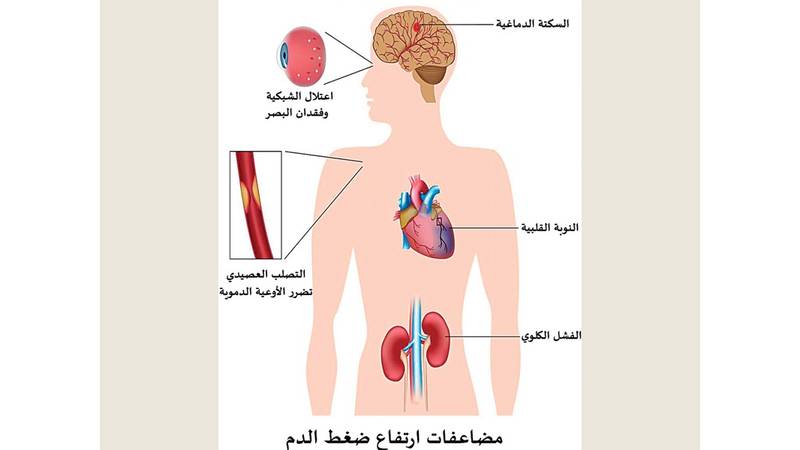 نصف الشباب العرب معرضون للإصابة بضغط الدم المرتفع ملحق الصحة و الطب ملاحق الخليج