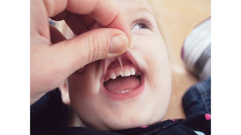 التهاون في تسوس الأسنان اللبنية عواقبه وخيمة على صحة الطفل صحيفة الخليج
