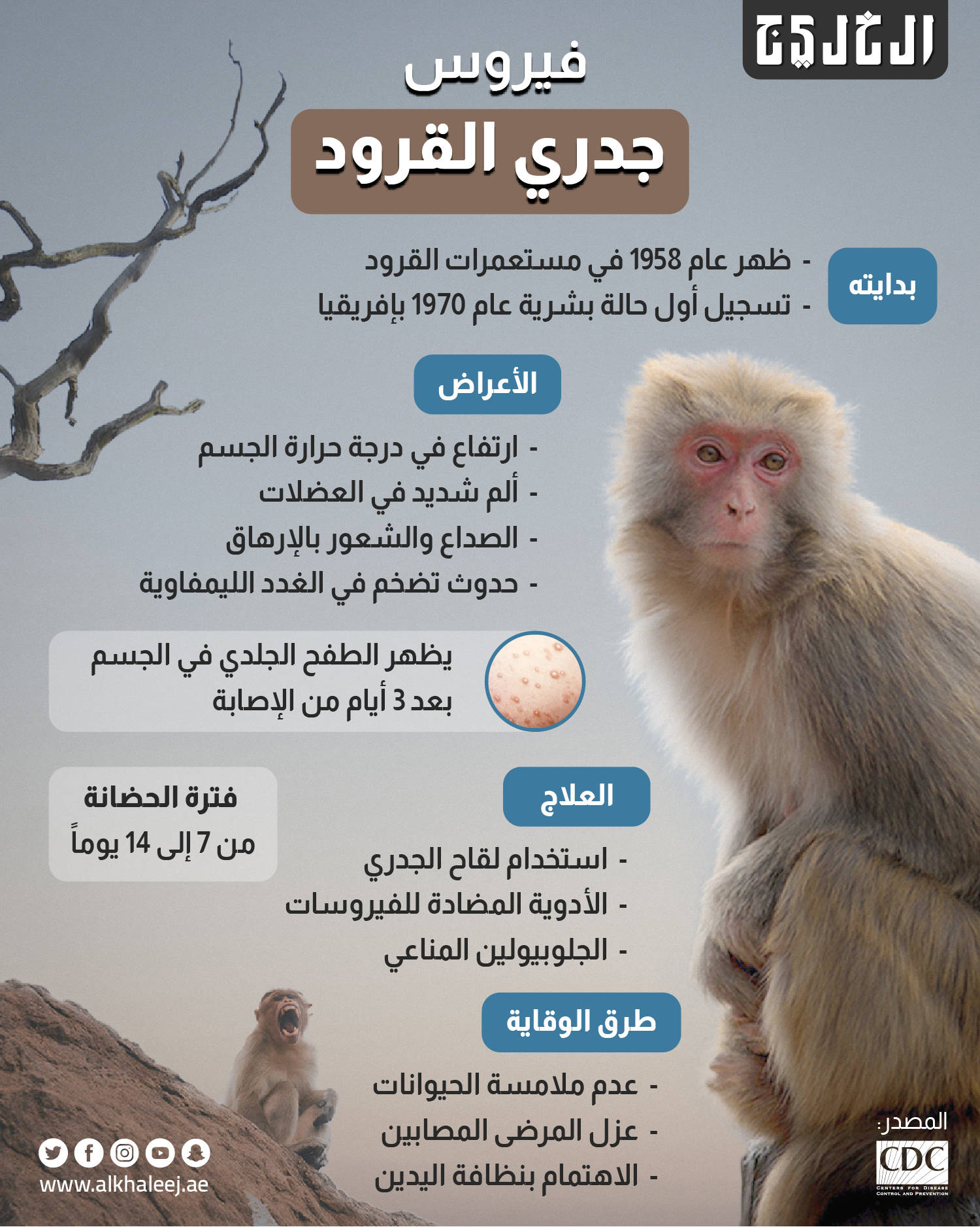 جدري القرود جدري القرود