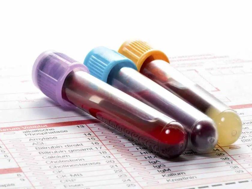 بعد سن الأربعين.. لا تتجاهل هذه التحاليل الستة قد تنقذك من أزمات مفاجئة #صحيفة_الخليج 