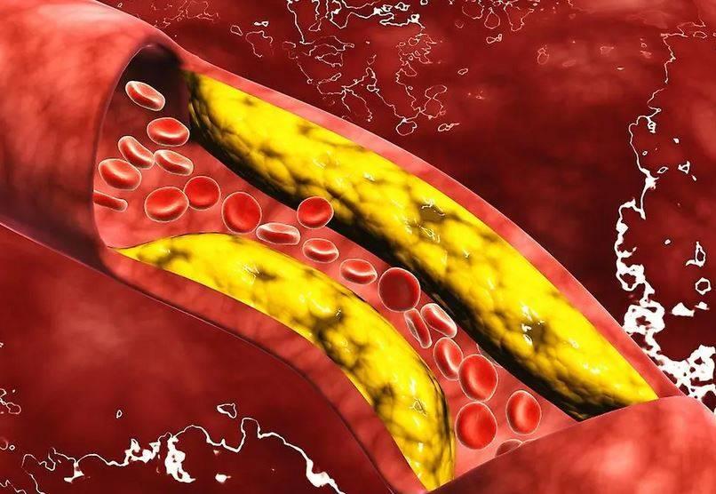 اكتشاف إنزيم يتحكم في زيادة الوزن ومستويات الكوليسترول #صحيفة_الخليج 