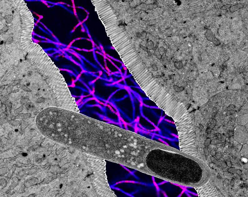 اكتشاف بكتيريا أمعاء تخفض سكر الدم #صحيفة_الخليج 