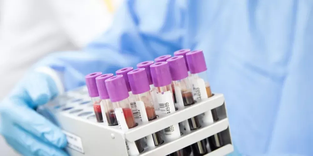 اختبار دم يتنبأ بمخاطر الوفاة المفاجئة لمرض قلب وراثي #صحيفة_الخليج 