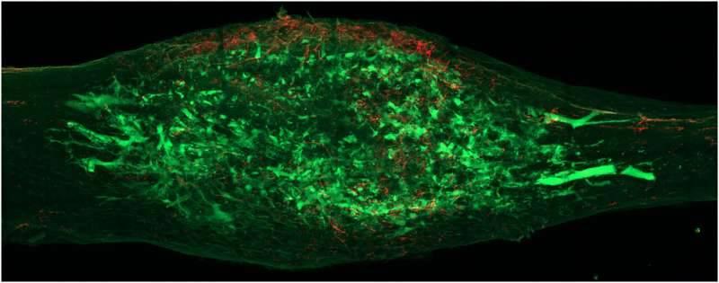 أول خريطة تفصيلية لدائرة الأعصاب في العظام #صحيفة_الخليج 
