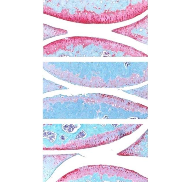 عاجل| دواء سحري يمنح الغضاريف فرصة ثانية للتجدد تلقائياً 